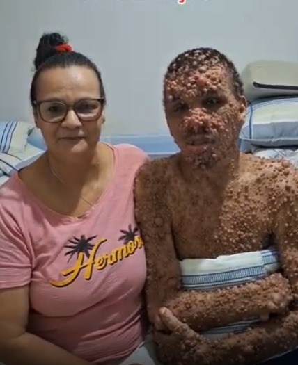 Pessoas em tratamento